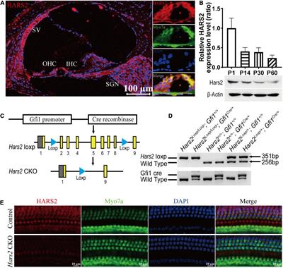 Disruption of Hars2 in Cochlear Hair Cells Causes Progressive Mitochondrial Dysfunction and Hearing Loss in Mice